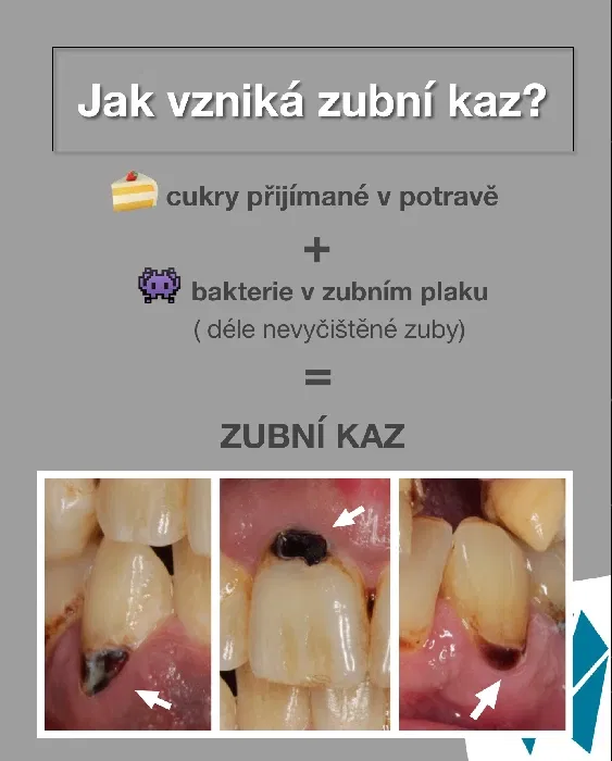 NOVINKY-ZUBN-KAZ.webp
